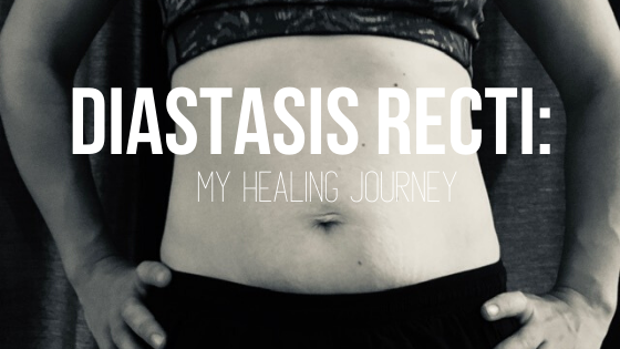 Diastasis Recti Part 2: What Can I Do?